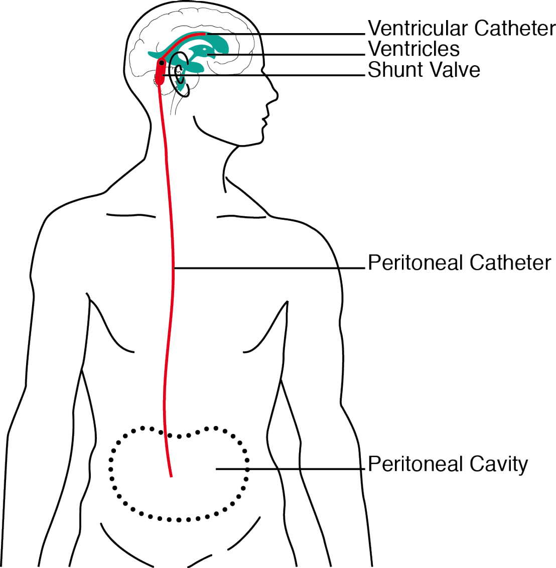 cerebrospinal-fluid-wikipedia